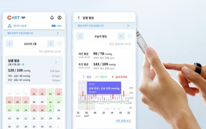 스카이랩스, 개인용 반지형 혈압계 ‘카트 비피’ 출시