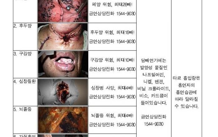 담뱃갑 새 경고그림·문구 23일부터 적용…경고효과 극대화